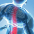 EFFECTIVELY MANAGING BACK PAIN